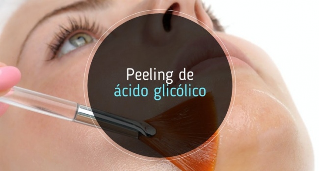 Todo lo que necesitas saber sobre los peelings con ácido glicólico