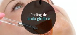 Todo lo que necesitas saber sobre los peelings con ácido glicólico